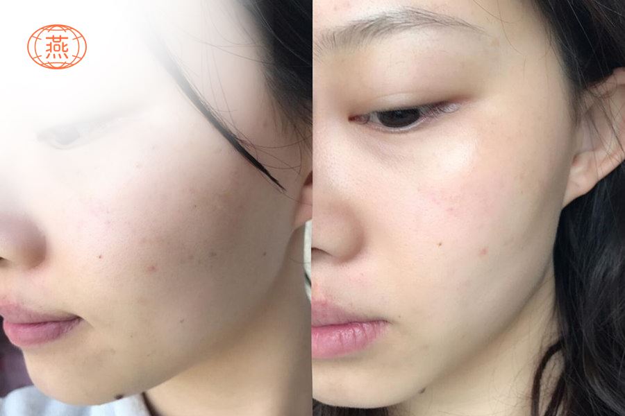 燕窝对女人的功效